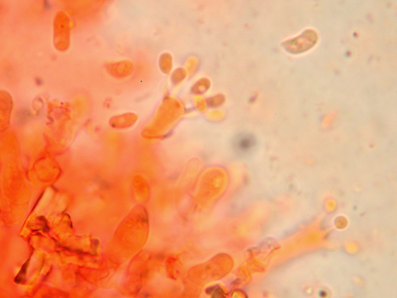 Sistotrema brinkmannii